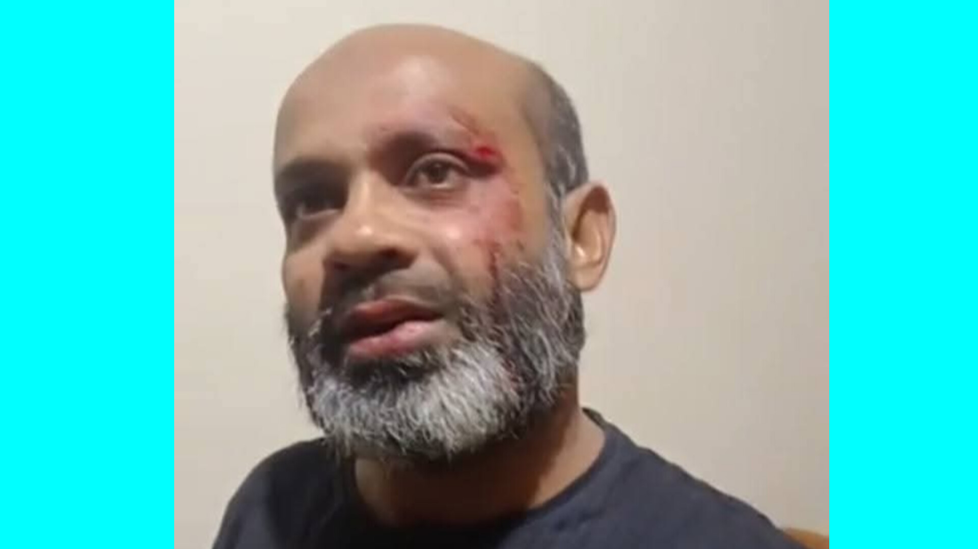 রায়পুরা উপজেলার হাইরমারা ইউনিয়ন যুবদল নেতা মোয়াজ্জেমের ওপর হামলা।