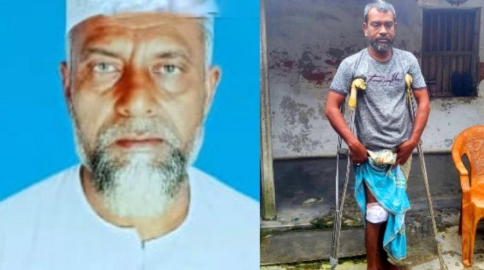 নাটোরে ভুল অস্ত্রোপচারে কৃষকের মৃত্যু, তিনজন পঙ্গুত্ববরণে