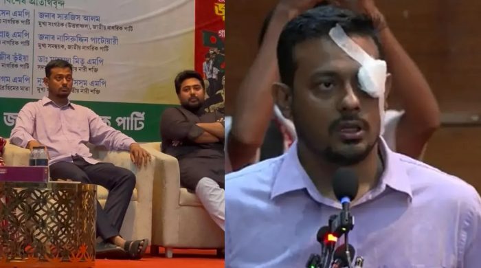 নাসীরুদ্দীন পাটওয়ারীর চোখে ব্যান্ডেজ, হামলার প্রতিবাদ