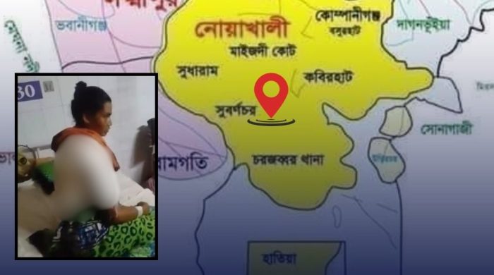 নোয়াখালীতে গৃহবধূকে ফুটন্ত গরম পানি ঢেলে ঝলসে দেওয়ার ঘটনায় গ্রেপ্তার ২